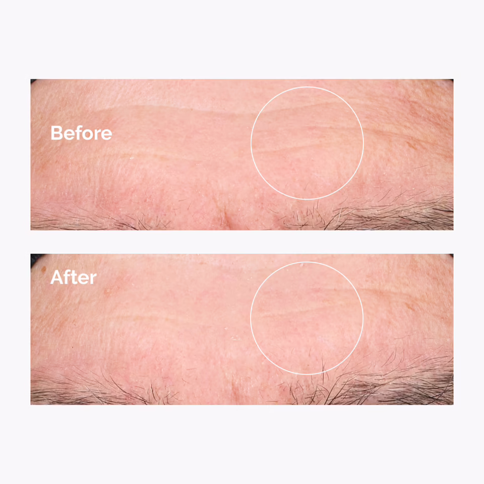 Hyaluronic Acid 2% + B5  30ml - Derinlemesine Nemlendirici Serum