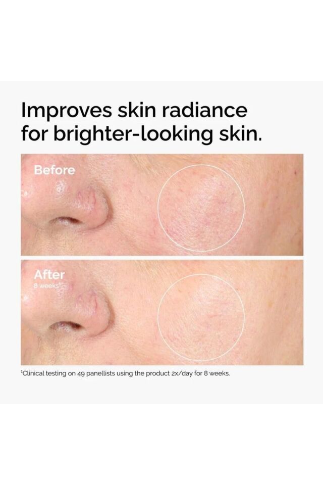 Alpha Arbutin 2% + HA 30ml