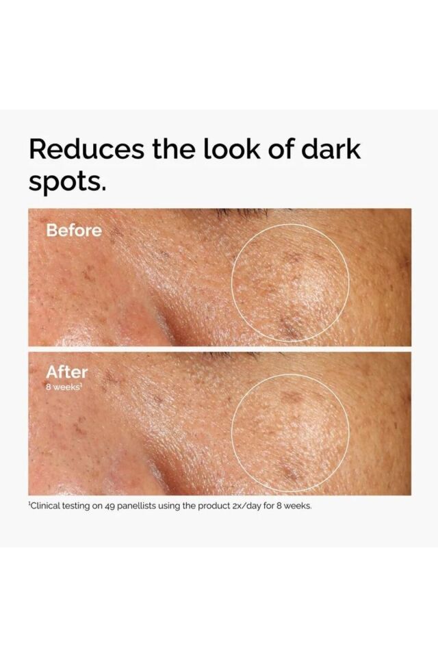 Alpha Arbutin 2% + HA 30ml