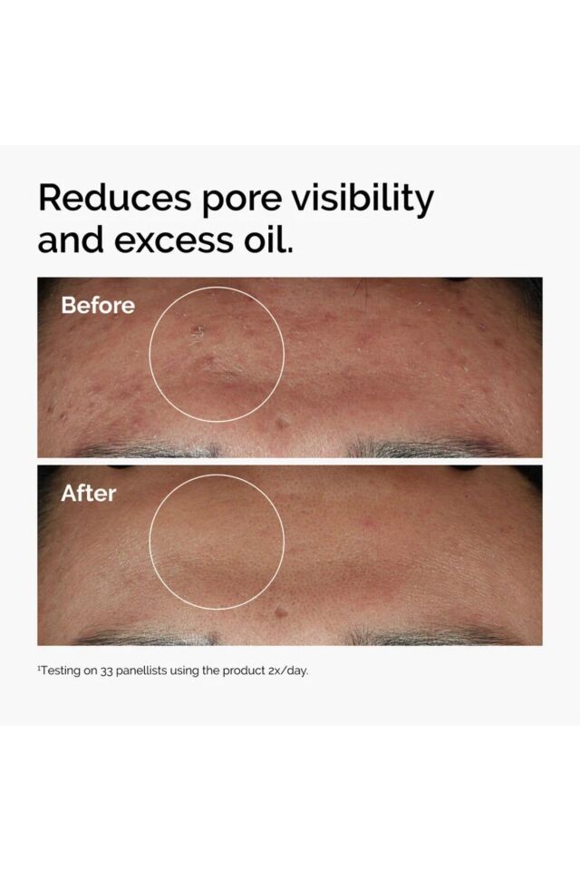 Niacinamide 10% + Zinc 1%  30ml - Leke ve Gözenek Görünümü Karşıtı Serumu